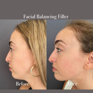 facial-balancing-nyc-54