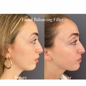 facial-balancing-nyc-55