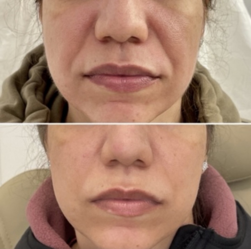 facial-balancing-nyc-72