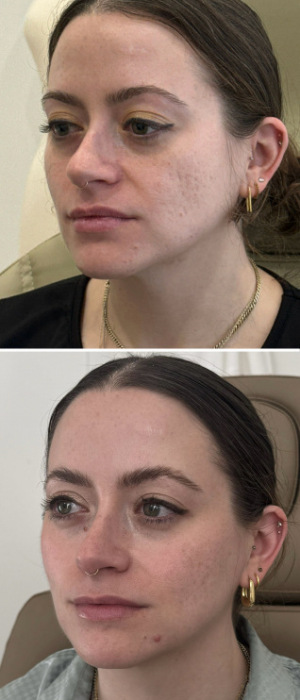 facial-balancing-nyc-74
