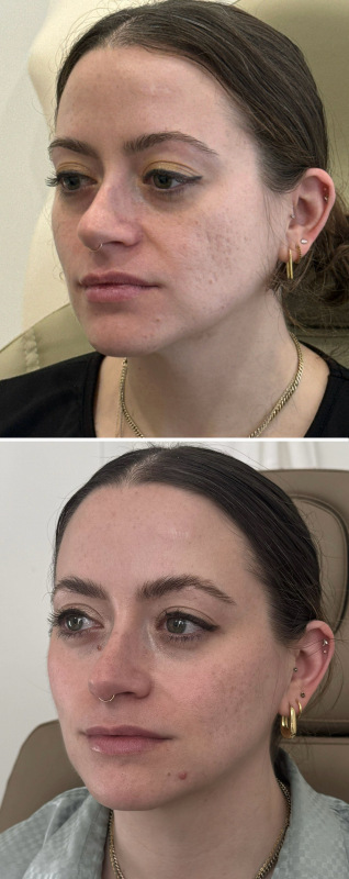 facial-balancing-nyc-74