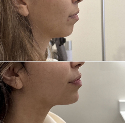 facial-balancing-nyc-76