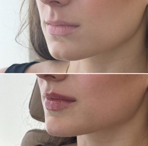 facial-balancing-nyc-78
