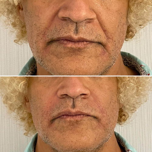 facial-balancing-nyc-79