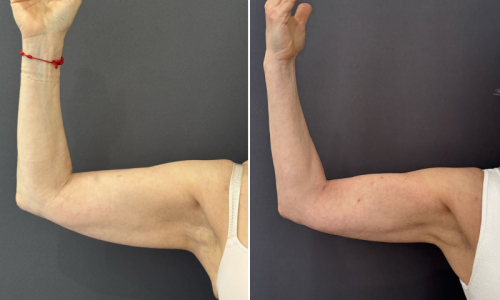 truflex-muscle-toning-nyc-6
